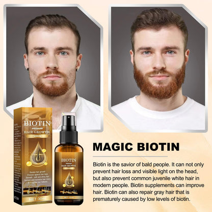 （🔥LAST DAY SALE-80% OFF) Seurico™ Biotin Premium Hair Growth Serum