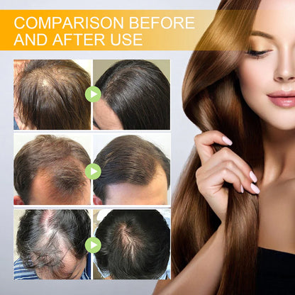 （🔥LAST DAY SALE-80% OFF) Seurico™ Biotin Premium Hair Growth Serum